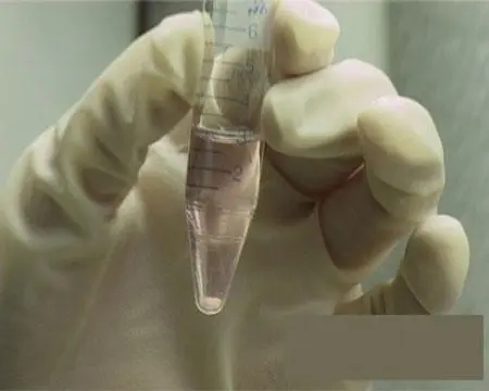 人工受孕医院 人工受孕医院排名